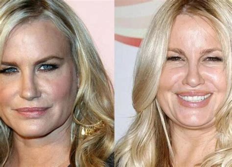 jennifer coolidge before surgery|Jennifer Coolidge Was Slammed With Plastic Surgery。